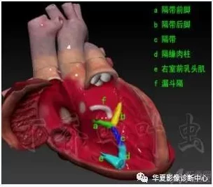 卵蛋图解最新版本已发布新增高清解剖图和3D模型